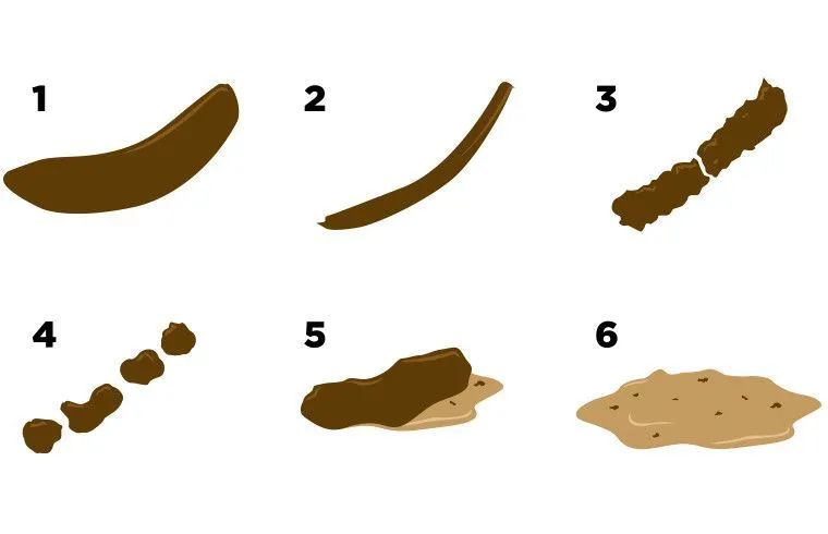肛肠排便时大便总是不成形可能是和这几个因素有关