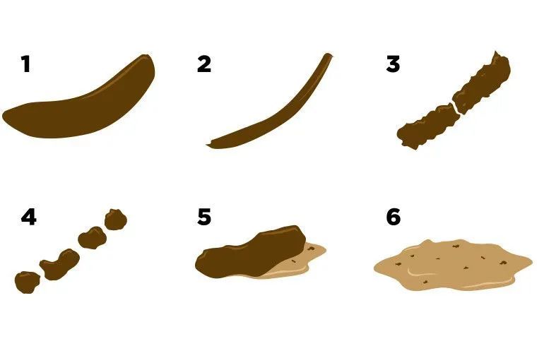 西安东大肛肠医院丨排便时大便总是不成形多与这几个因素有关