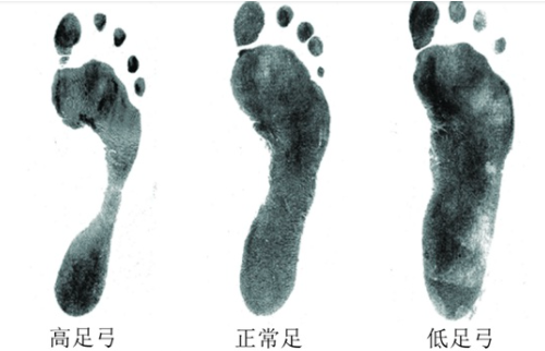 越轻真的越好?还在这样选跑鞋?怪不得你越跑越伤!