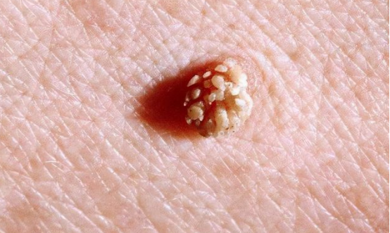 腾讯内容开放平台