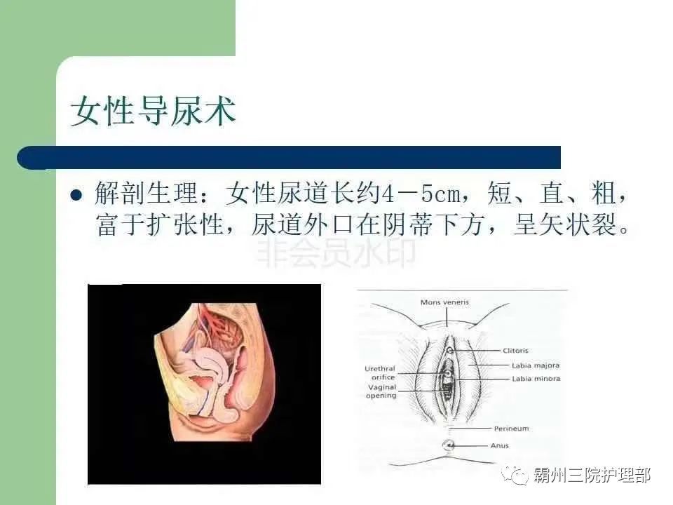 ppt导尿技术的操作流程及拔管后护理