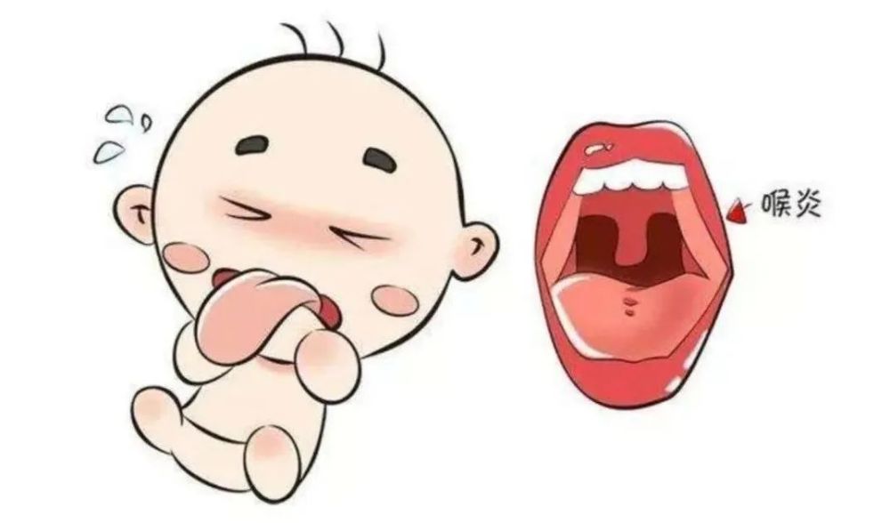 的婴幼儿,由于小儿喉部的解剖特点,喉腔狭小,喉软骨柔软,会厌软骨舌面