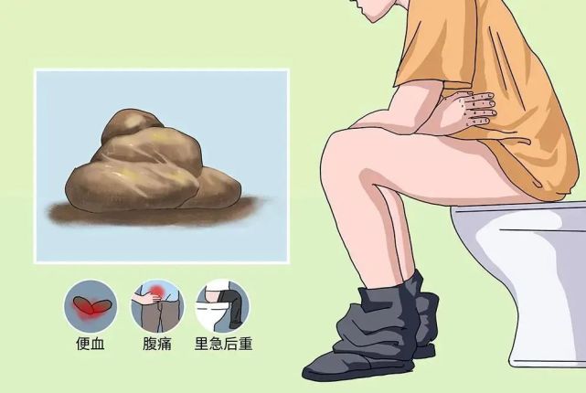 大便里发现这种东西可要当心了