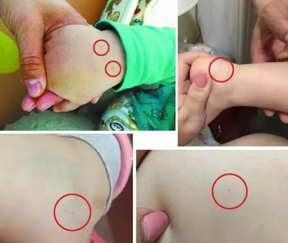 学费高达12万的高端国际园再现扎针虐儿5名幼儿遭毒手