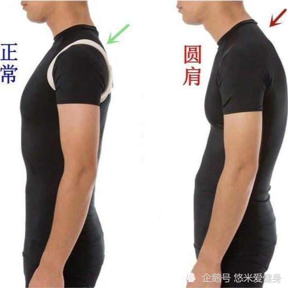 胸肌太厚造成圆肩怎么办?