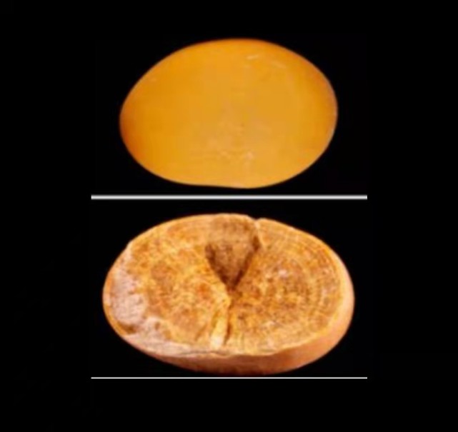 草酸钙结石显微镜图片