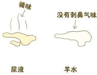 在收缩肛门和阴道的时候,停止的是尿液,反之就是羊水