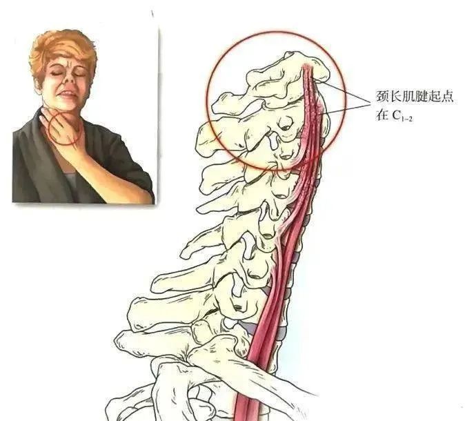 中外06颈胸椎棘突间滑囊炎临床综合征颈椎下部和胸椎上部的棘突间韧带