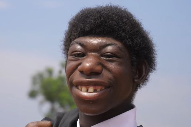 男子患小头畸形症被全村人歧视,只能逃到丛林生活,如今怎样了