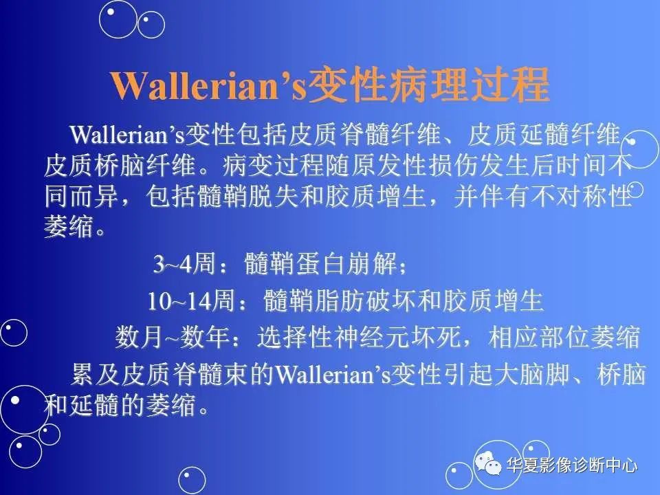 神经系统华勒氏变性