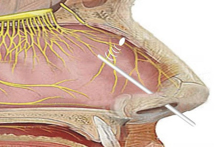 鼻粘膜干燥,发痒怎么办|鼻粘膜|鼻黏膜|鼻腔