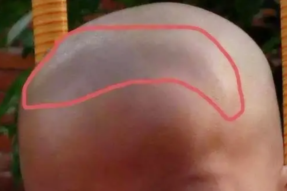 囟门什么时候闭合最合适太早或太晚都不行宝妈要注意