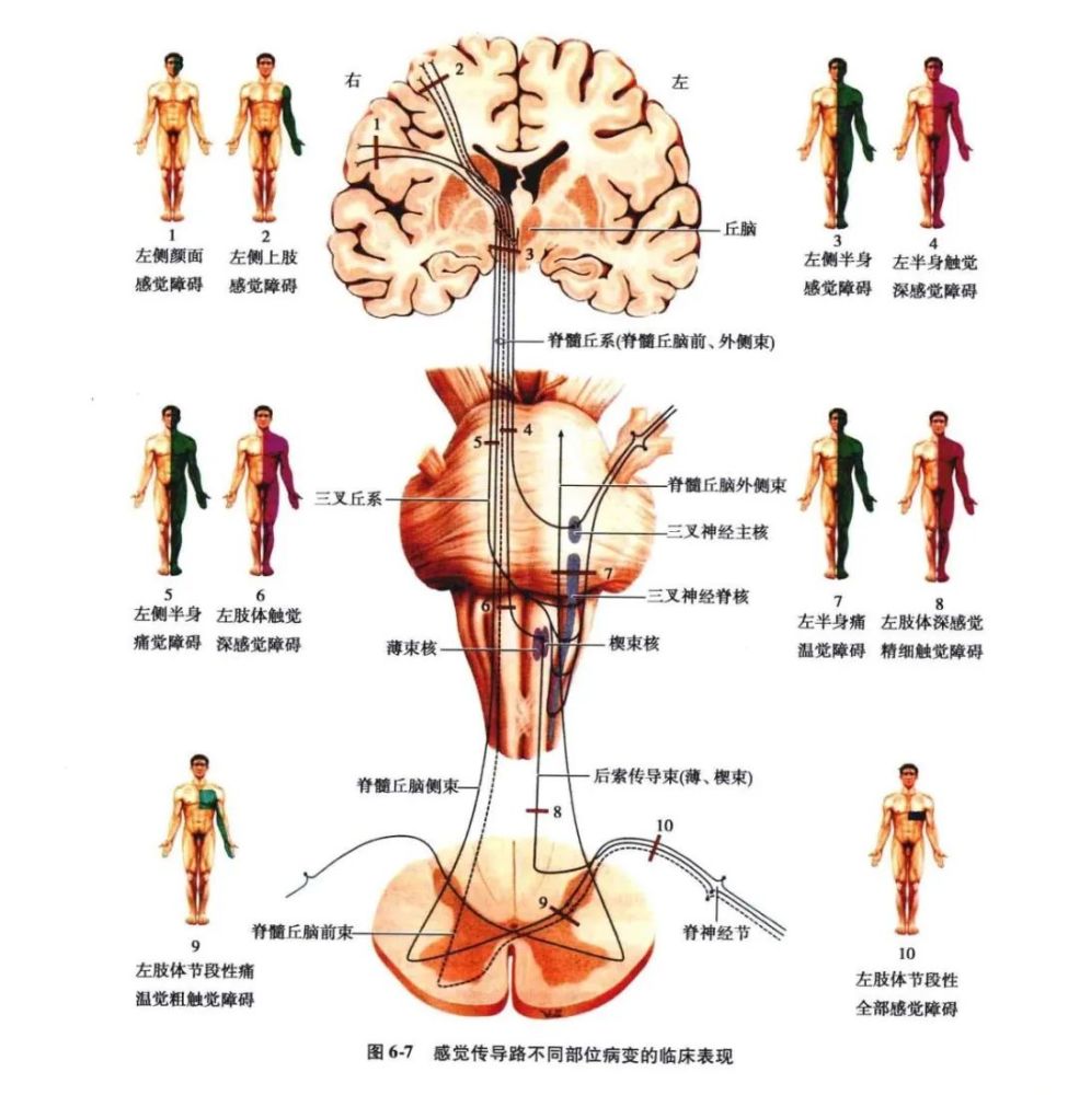 感觉传导通路解剖精讲及定位诊断