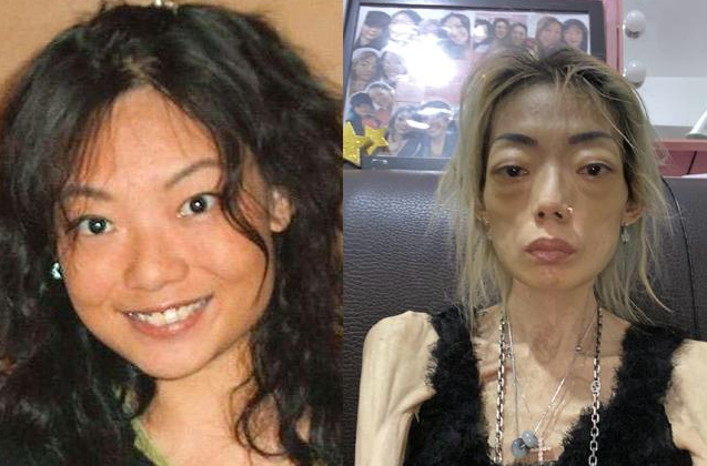 她22岁嫁入豪门,8年暴瘦到只剩44斤,曾经风光无限的她究竟经历了什么