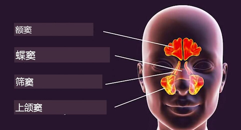 上頜竇在眼睛下方,額竇在眼睛上方的額頭部位,篩竇在兩眼之間,蝶竇在