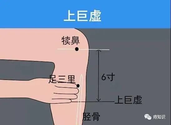 臨床醫案:手法按摩治癒20年混合痔_騰訊新聞