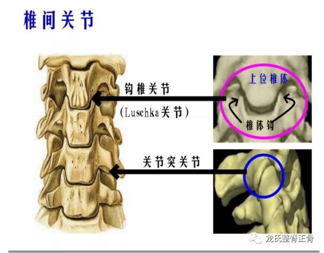 "颈椎错位"即"颈椎小关节错位"亦称"颈椎小关节功能紊乱"是指骨与骨