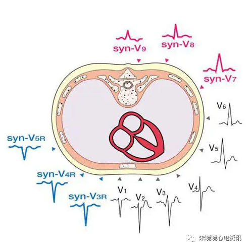 心电图导联向量图片图片