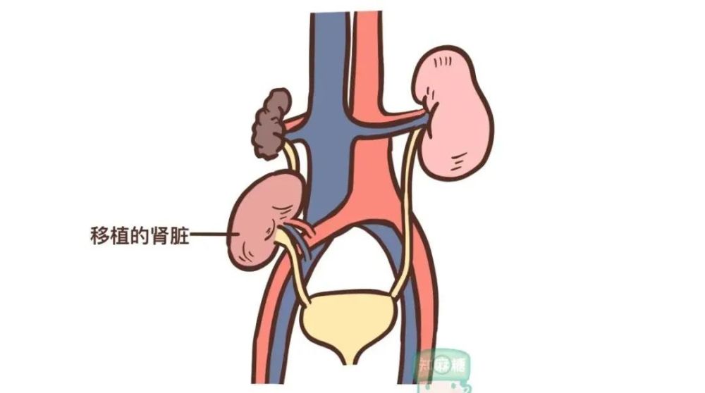 移植了豬的腎臟,我們會不會變成豬?