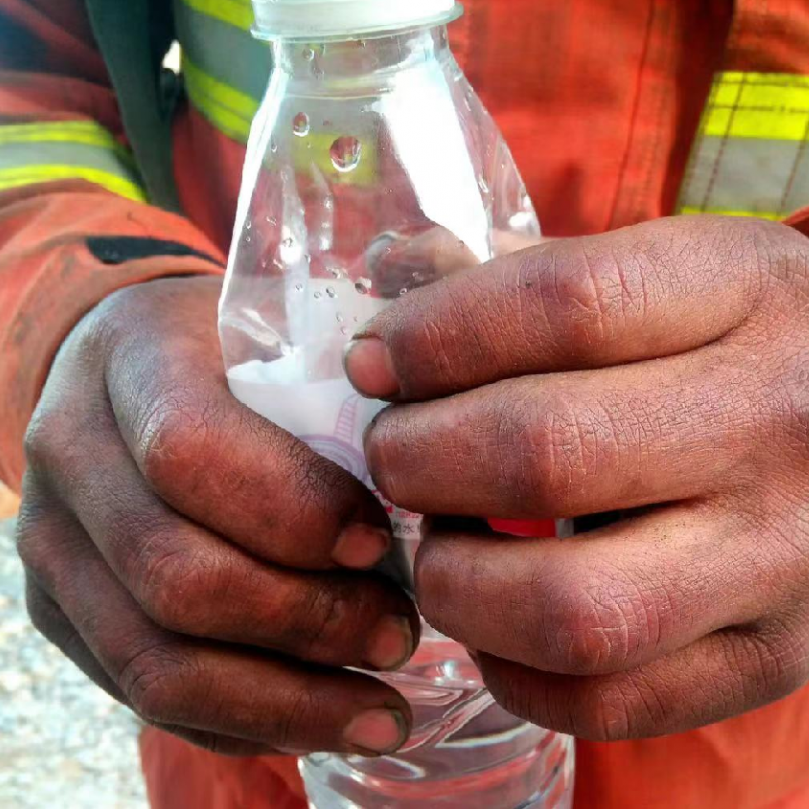 消防员张志顺的手