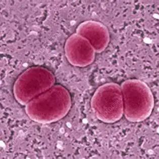 脑膜炎奈瑟菌培养基图片