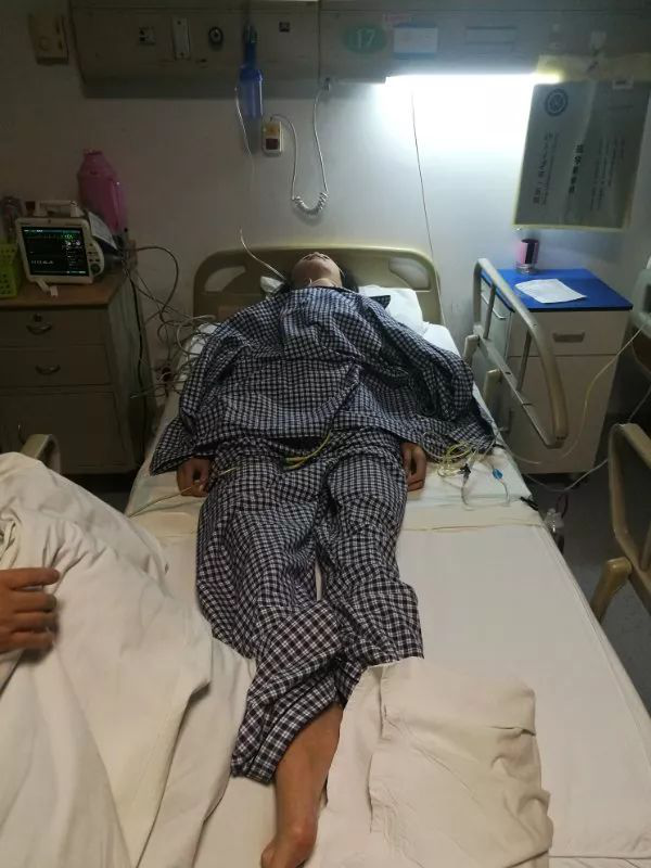 李先发恢复一段时间后,又做了腿部塑型手术,这需要将她的腿骨多处打断
