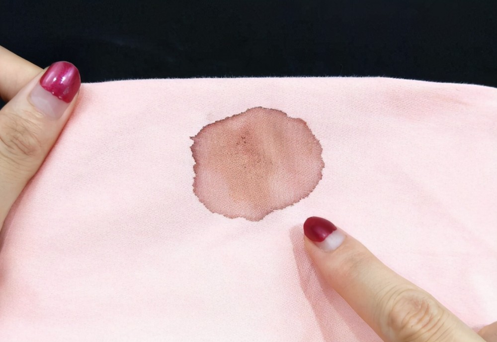 感染了hpv病毒之后,女性的白带是会出现一个明显的变化.