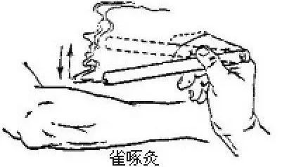 艾灸养生,一定要知道的艾灸手法!