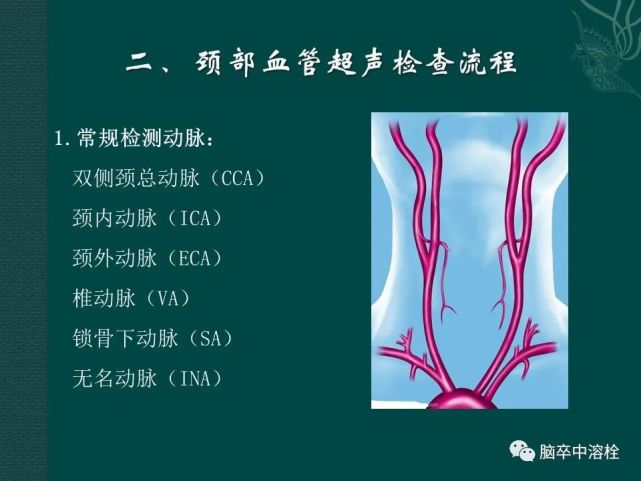 頭頸部血管超聲規範