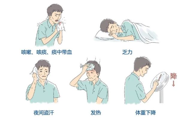 耐多药结核病的症状与普通结核病大致相同 主要有: 咳嗽, 咳痰, 痰中