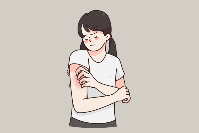 秋冬发痒起风团荨麻疹该怎么办