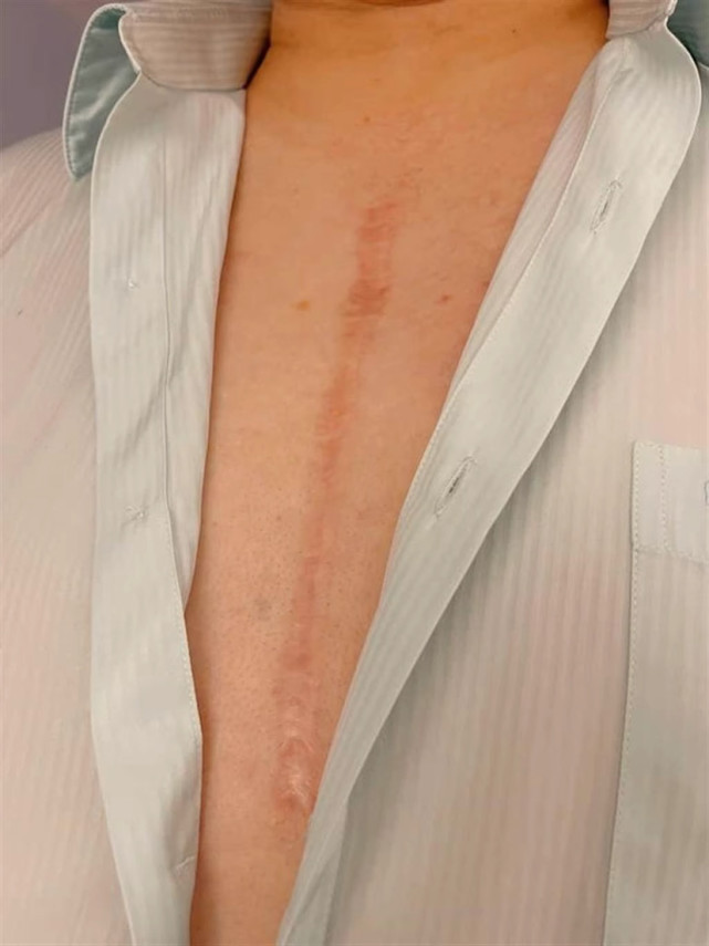 何博文宣称,小时候曾做过心脏手术,"我兵役体检,复检都被