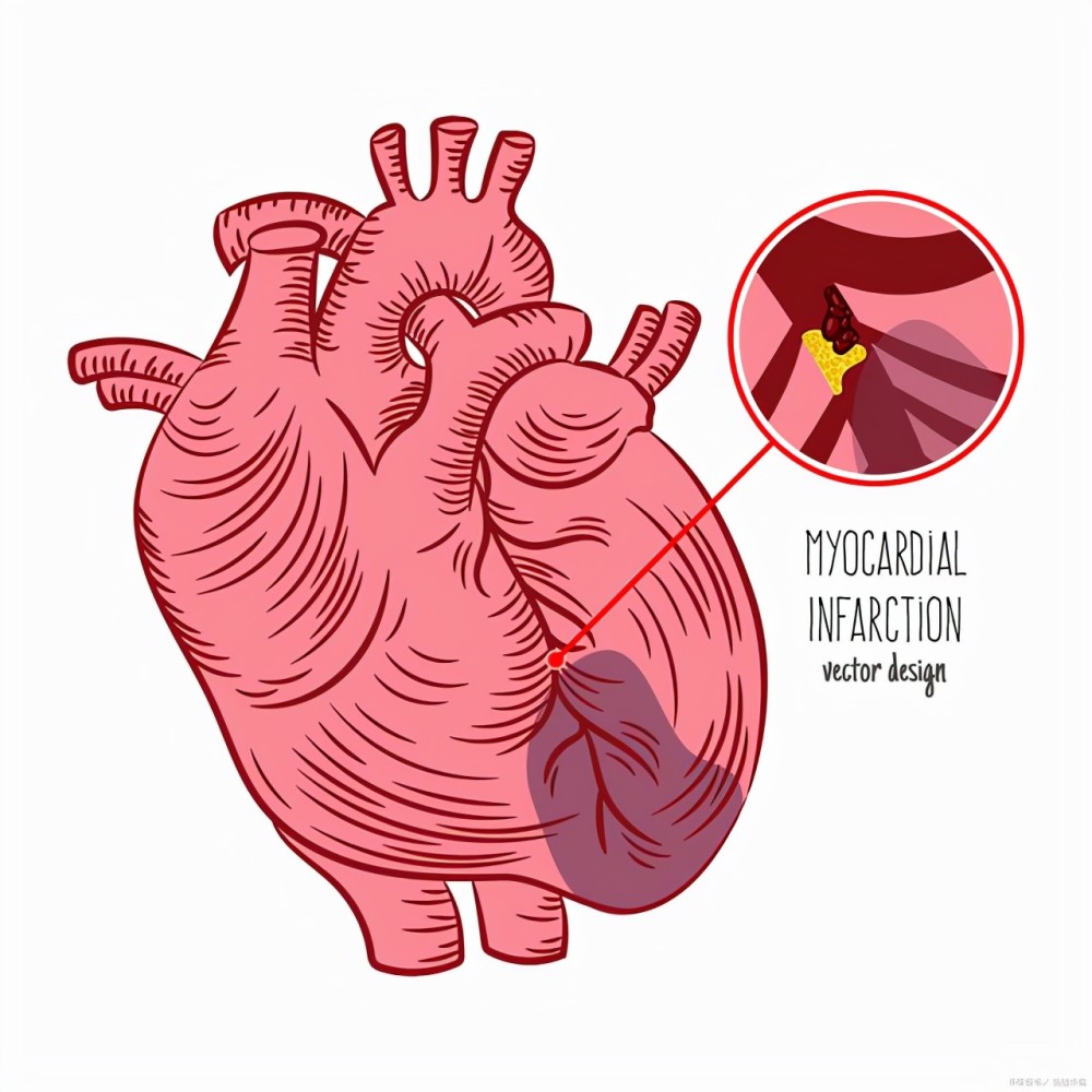 38歲患者的心血管提前老化這6種原因會誘發心肌梗死