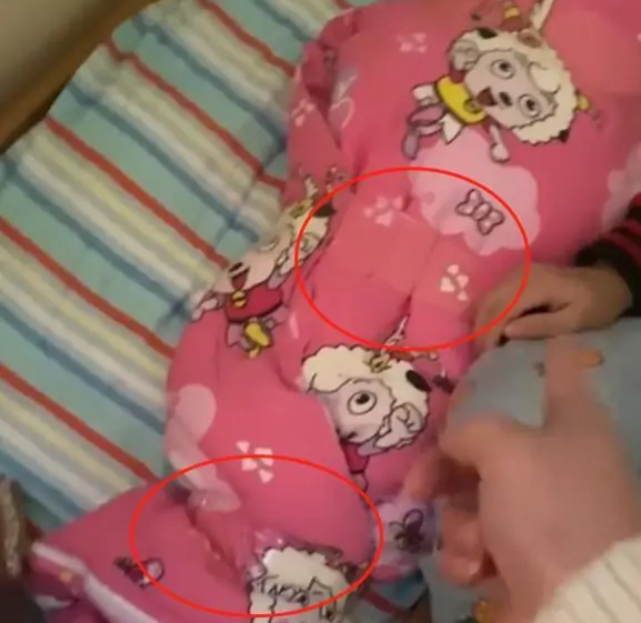 四川一3岁女童被老师裹被子里用胶带捆绑午休,老师在一旁玩手机