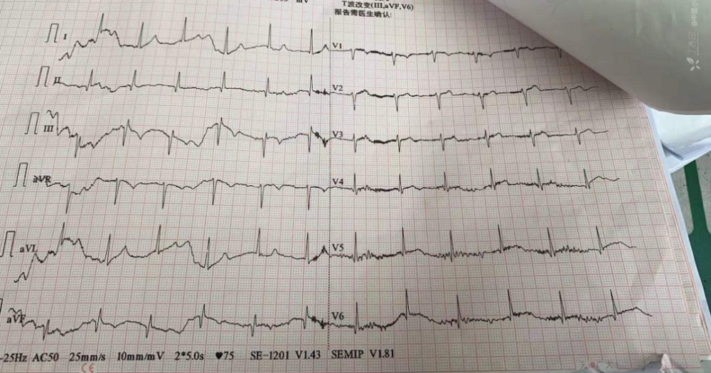 劇烈乾嘔入院6小時後休克死亡死因意想不到