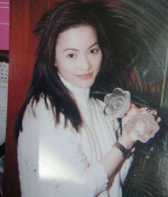 后来好不容易治好了脱发问题,但是因为治疗耗时太长,樊亦敏有段时间