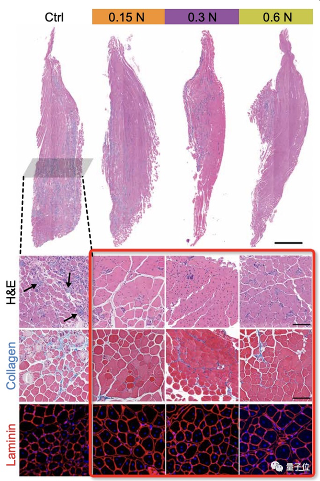 科学家们再测量了两组肌肉纤维化占比图发现,按摩后的小鼠肌肉纤维化