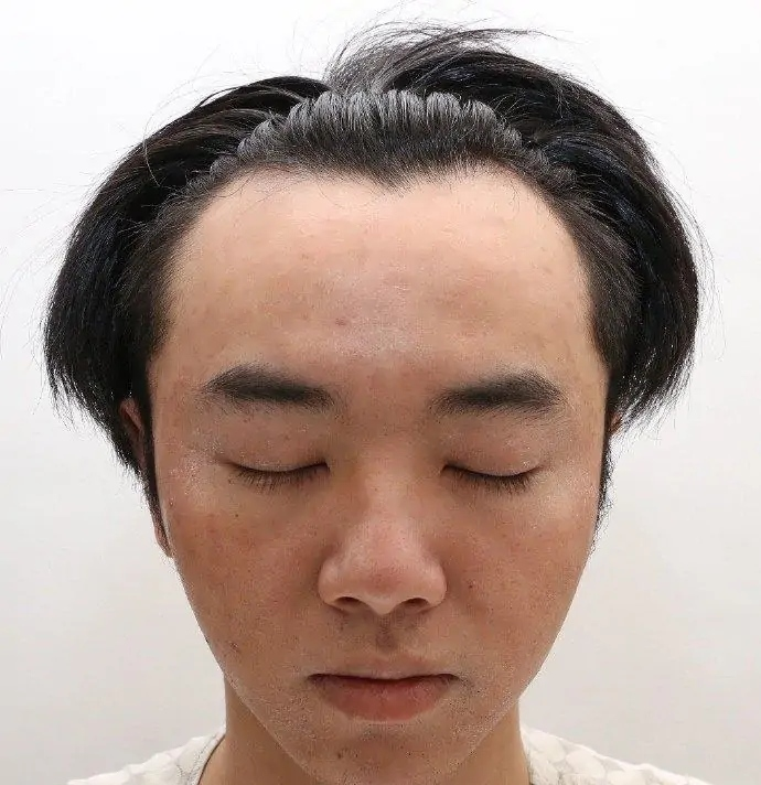 鲜肉头秃群像千玺发际线高王一博背头脑门亮最社死的还是他