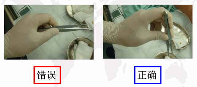 持镊子姿势:执笔式,始终保持垂直向下的姿势(六)换药过程中观察伤口