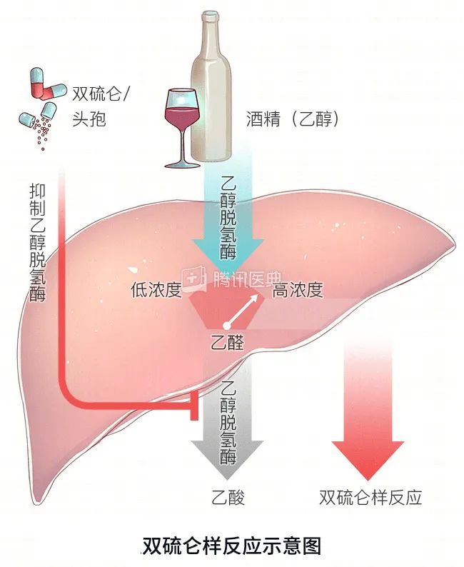 酒精在肝脏中会代谢成有毒的乙醛,需要乙醛脱氢酶来解毒;而双硫仑刚好