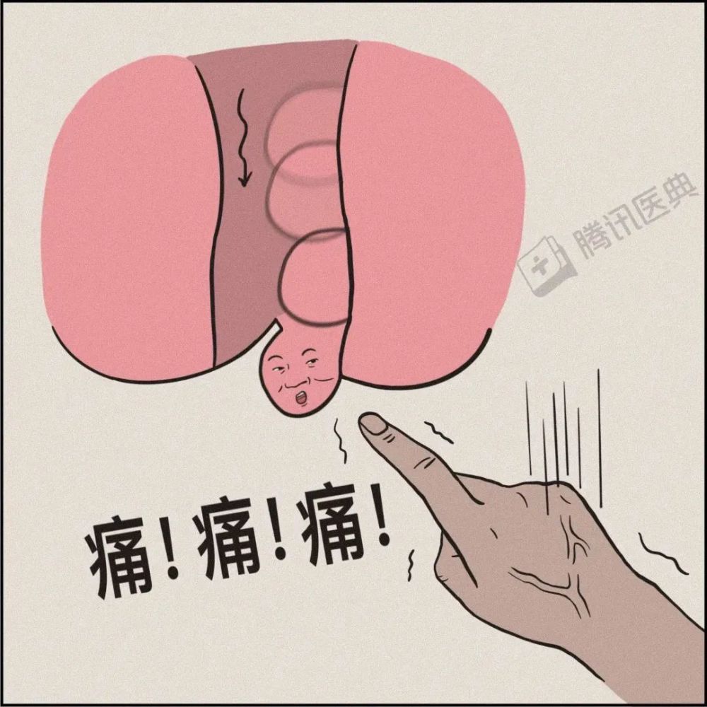 这时,脱垂出去的痔块如果很难回到肛门内,还会合并疼痛,瘙痒等症状.