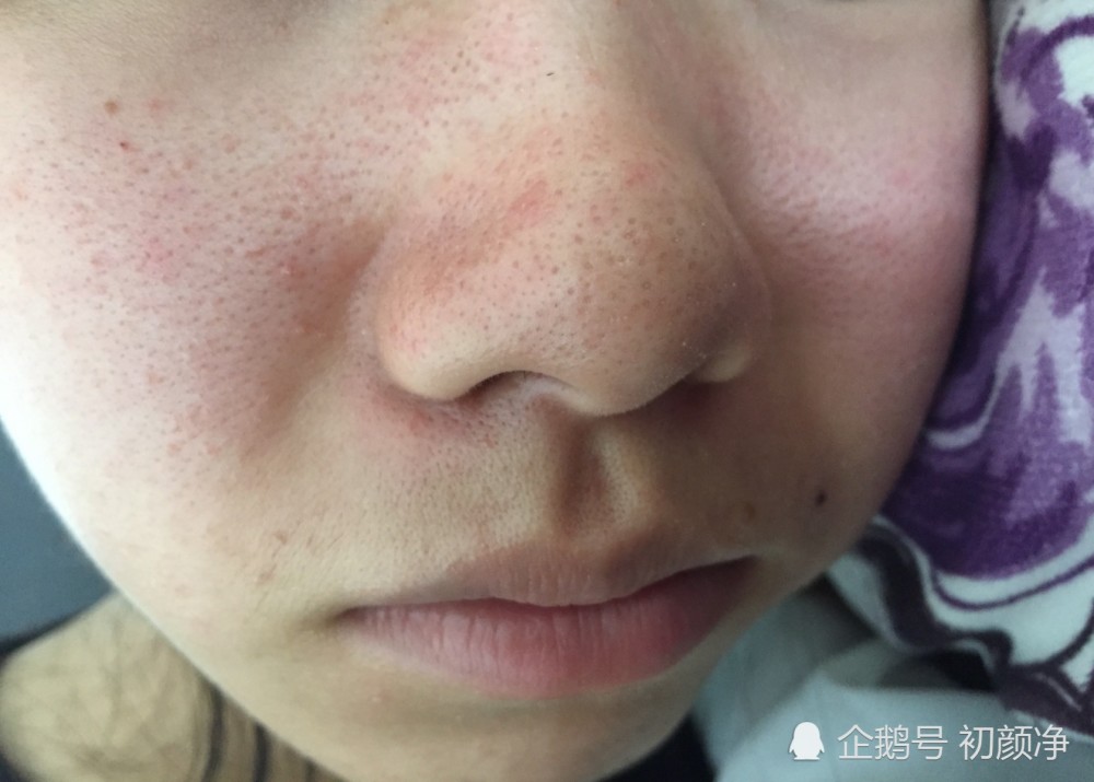 皮肤平衡是这样构成的你知道吗