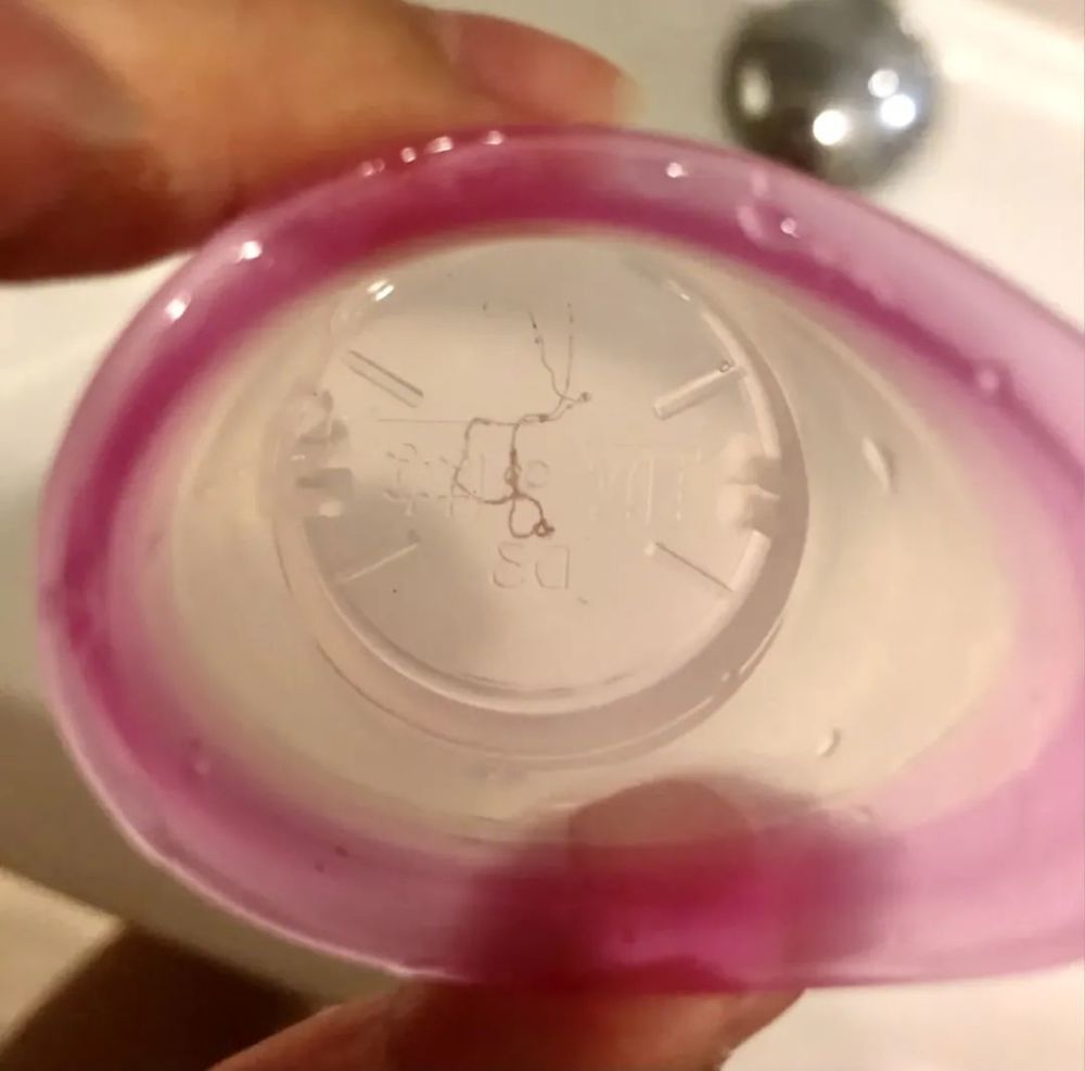 紧急提醒洗出闪亮少女眼洗掉眼里寄生虫这种洗眼液你用过吗