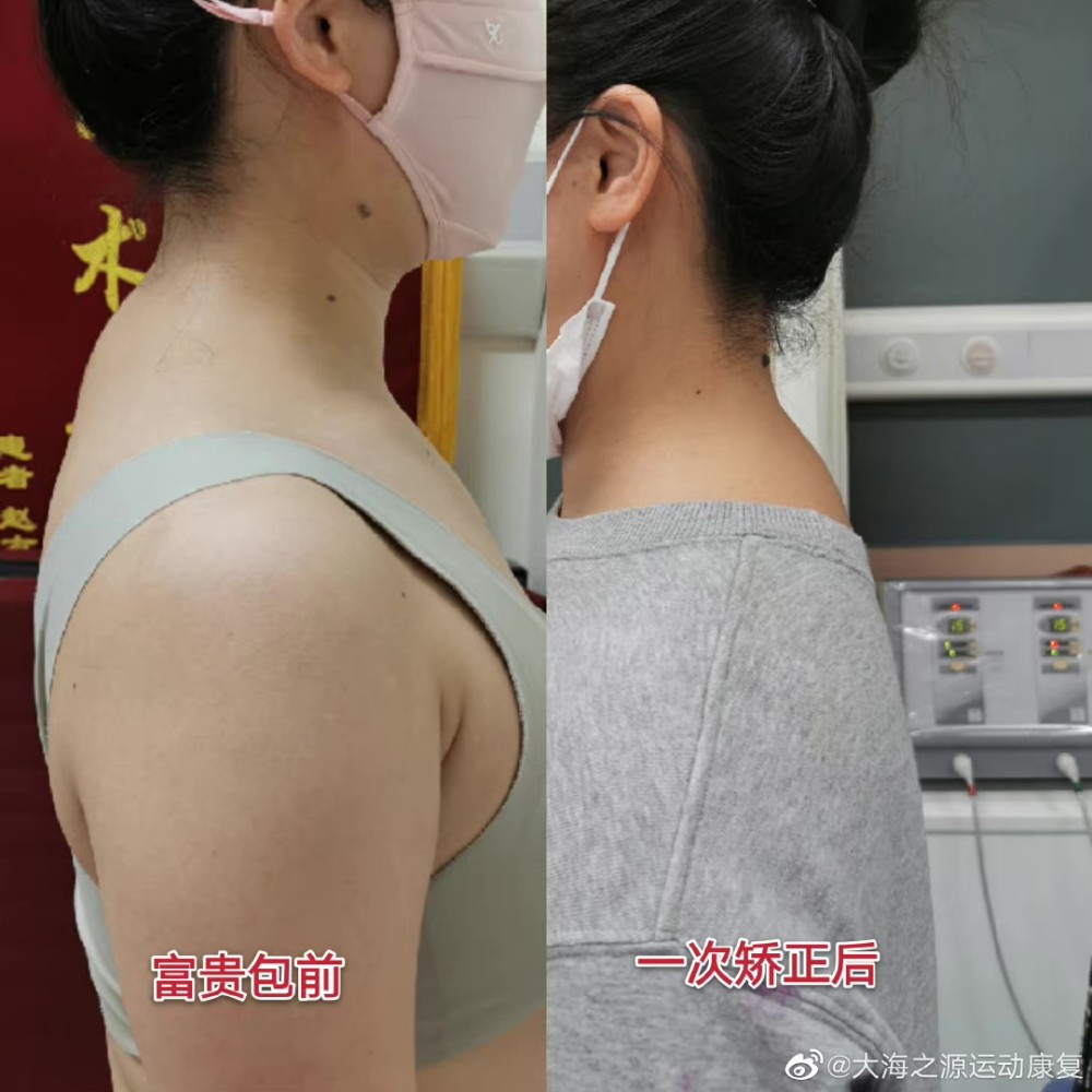 八,小球活络松懈七,挤压富贵包六,一呼一吸松解大