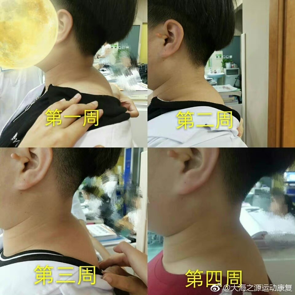 八,小球活络松懈七,挤压富贵包六,一呼一吸松解大