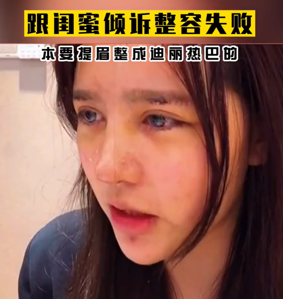 女生想整成迪丽热巴，整容失败留下疤痕，哭诉称不敢出去见人了