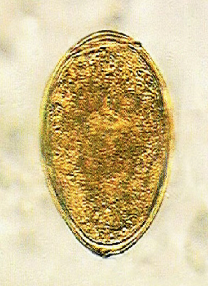 医生告诉记者,荸荠生长于地下沼泽或水田中,表皮多有细菌,比如姜片虫