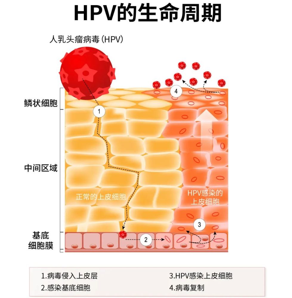 HPV是怎么感染的图片