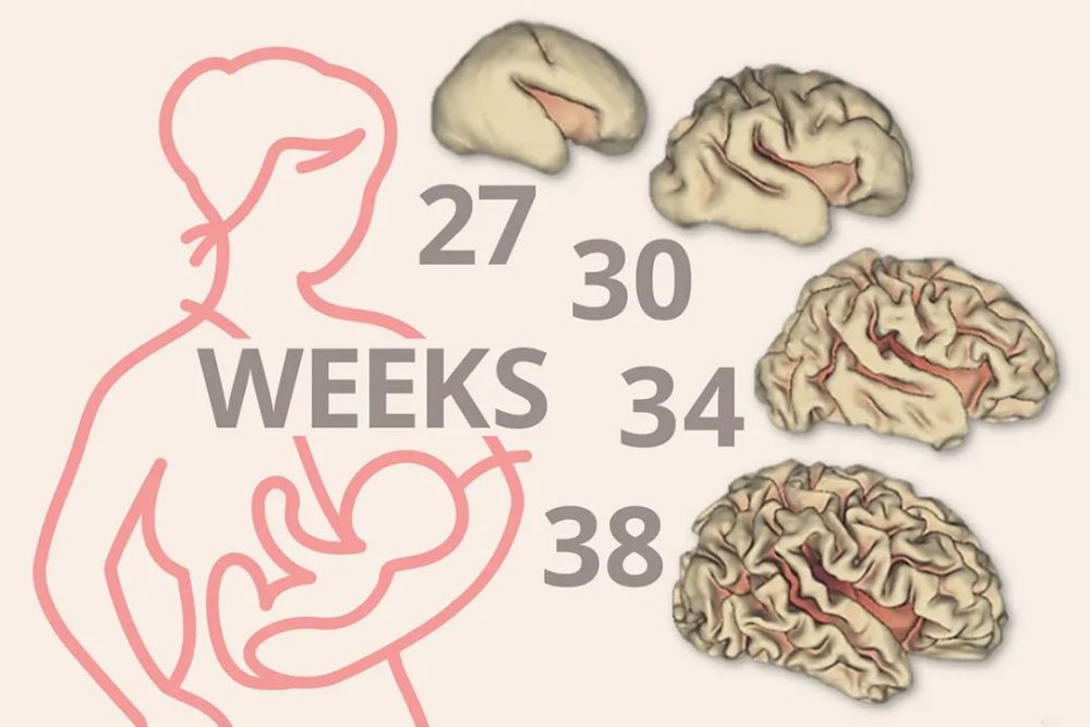 早產兒的大腦損傷和腸腦損傷 人類妊娠過程可分為三個獨立階段,每個