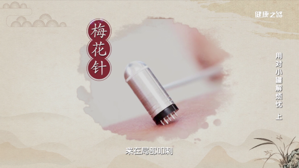 先用梅花针在局部皮肤进行叩刺,之后再进行拔罐.